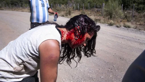 Conferencia de prensa sobre la represión en la marcha por Lago Escondido