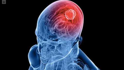 Conicet: un mecanismo podría mejorar la quimioterapia en tumores cerebrales